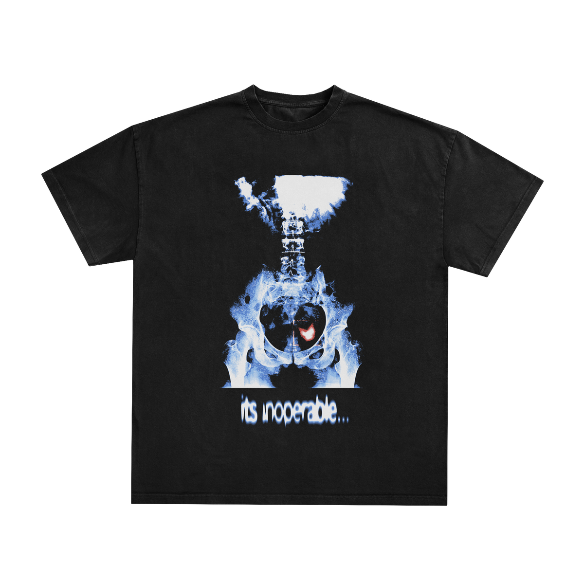 X-Ray Tee